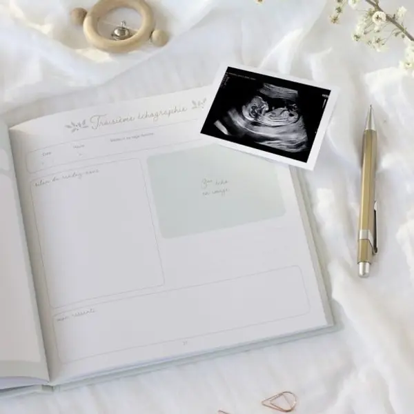Journal de grossesse Zü